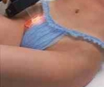 Лазерная и фотоэпиляция