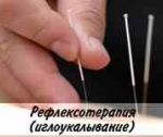 Как провести иглотерапию