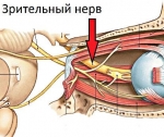 Лечение атрофии зрительного нерва